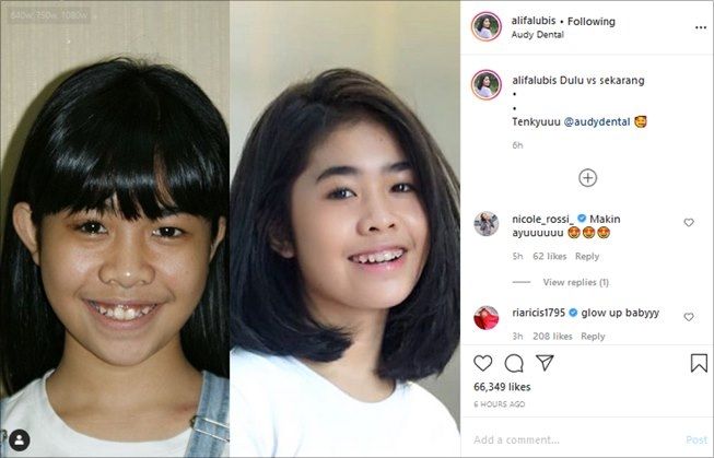 Penampilan Artis Cilik Alifa Lubis Berubah Drastis, Publik: Glow