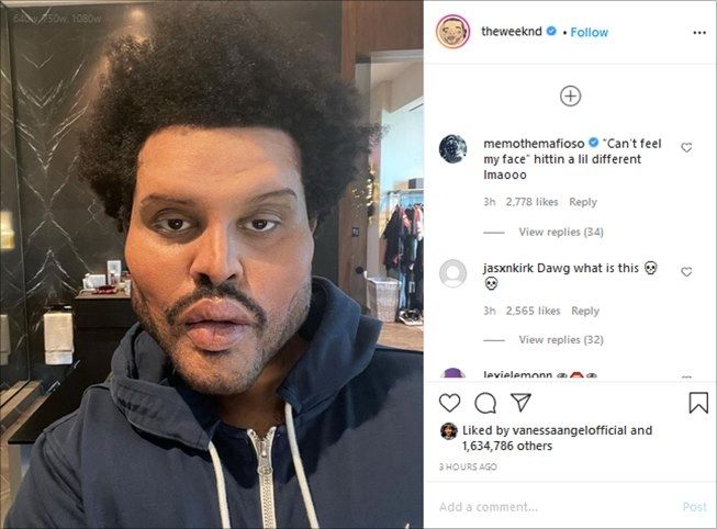 The Weeknd kembali tampil dengan riasan wajah nyeleneh. (Instagram/@theweeknd)