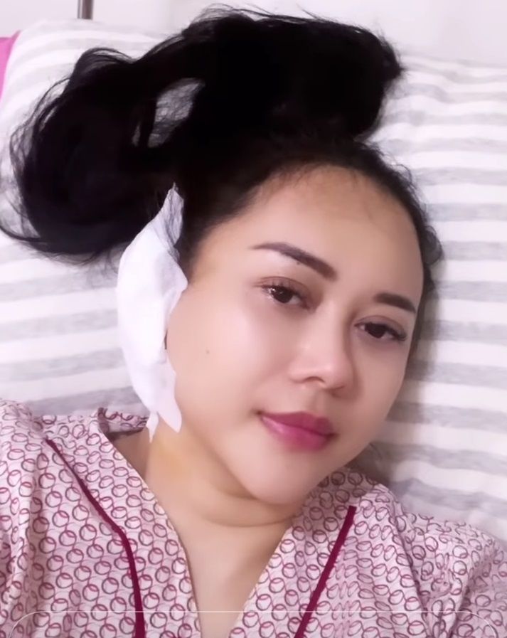Aura Kasih usai melakukan operasi di telinga. [Instagram]