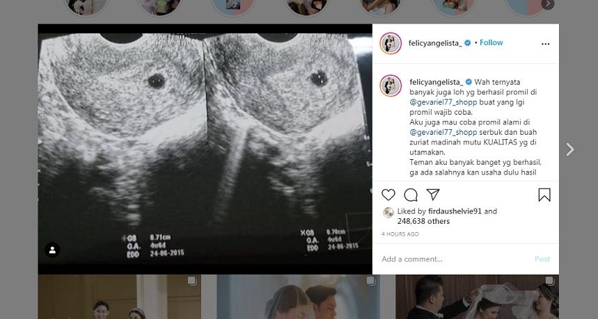 Unggahan Felicya Angelista [Instagram]