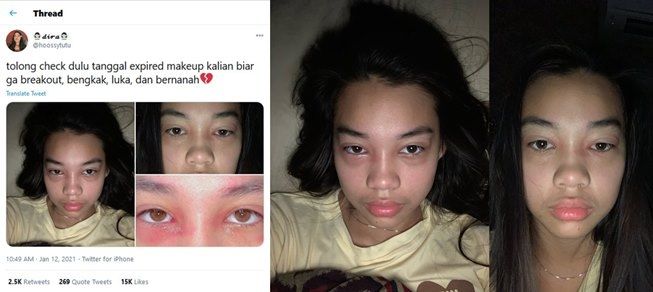 Viral wajah wanita bengkak dan bernanah karena pakai makeup kedaluwarsa. (Twitter/@hoossytutu)