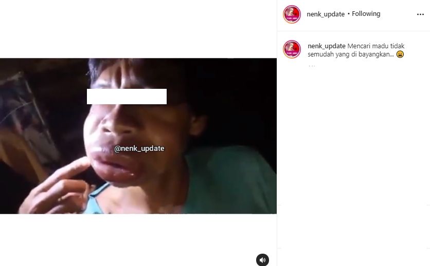 Video pria disengat lebah malah jadi bahan tertawaan. (Instagram/nenk_update)