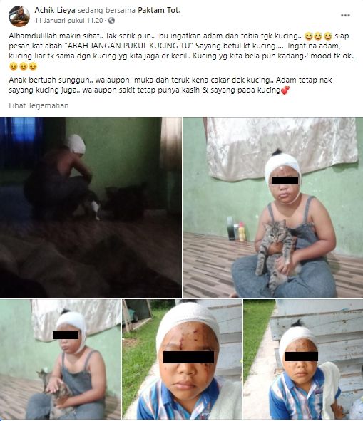 Kisah Haru Bocah yang dicakar kucing sampai muka penuh luka (Facebook/AchikLieya).