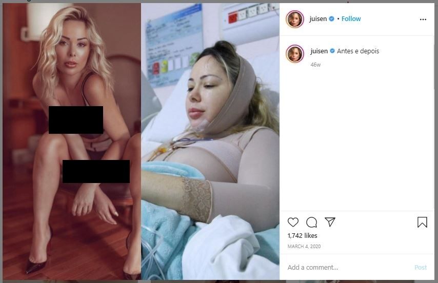 Model Playboy Habis 4 Miliar untuk Oplas (instagram.com/juisen)