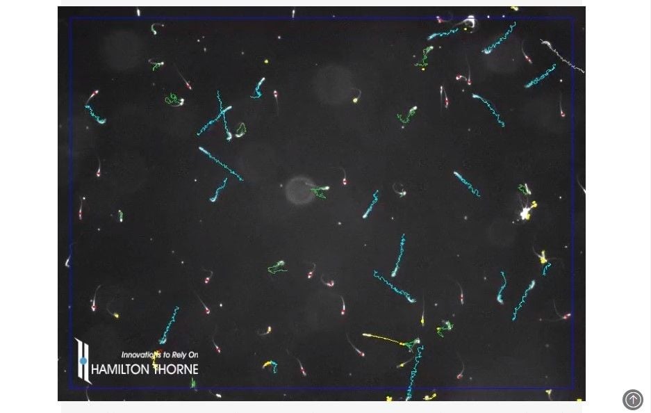 Gambaran sperma t-haplotipe (t) meracuni sperma lain (+) agar mencapai sel telur (Max-Planck-Gesell)