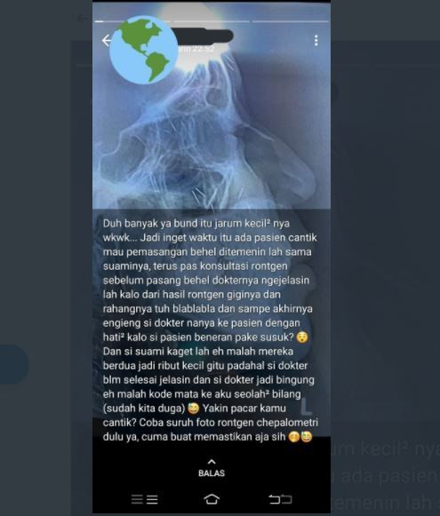 Viral Pasien Pakai Susuk, Ketahuan saat Rontgen hingga Ribut dengan Suami (twitter.com/txtdrstoryWA)