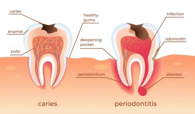 Gigi lapisan Pengertian Gigi