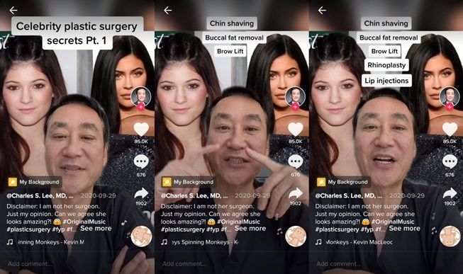 Bukan Cuma Filler, Dokter Bedah Sebut Kylie Jenner Permak Muka dengan Oplas. (TikTok/@drlee90210)