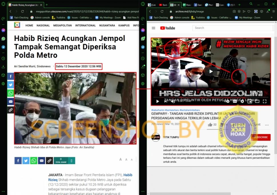 Fakta tangan Rizieq lebam dipelintir petugas (Turnbackhoax.id)