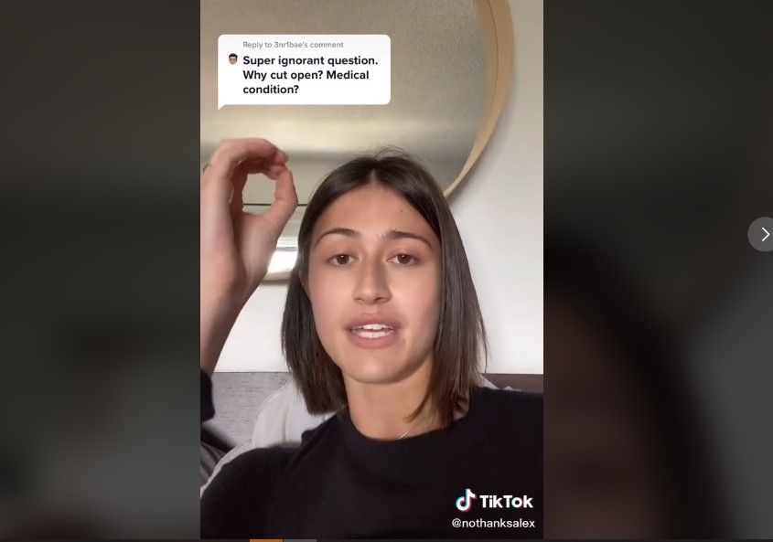 Gadis ini menjelaskan kista bartholin (TikTok/nothanksalex)