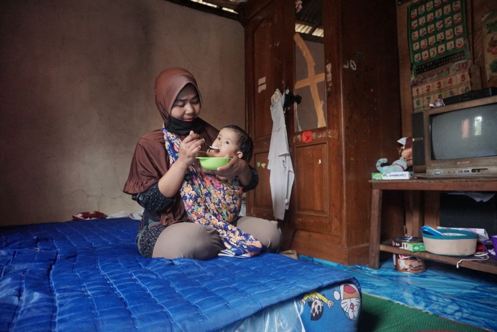 Balita penderita bibir sumbing Hilya Zuyinuha di Banjarnegara. [Suara.com/Citra Ningsih]