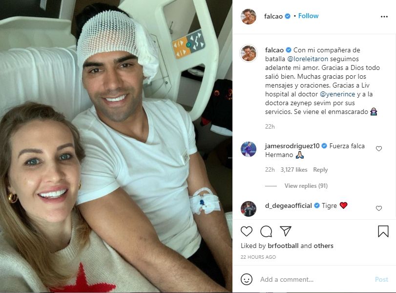 Radamel Falcao usai jalani operasi. (Instagram/falcao)