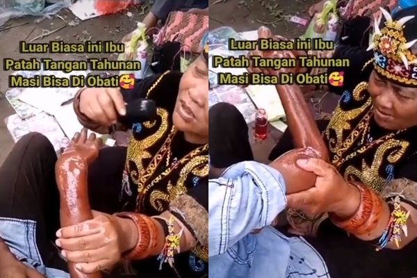 Viral Detik-Detik Wanita Dayak Sembuhkan Tangan Patah Tulang. (TikTok/@alvian2501)