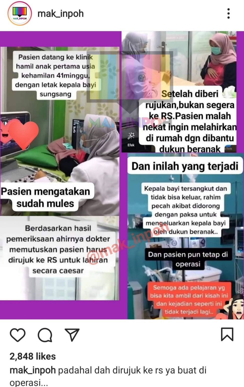 Viral Ibu Hamil Tolak Operasi Dan Memilih Ke Dukun Beranak Ini Akibatnya