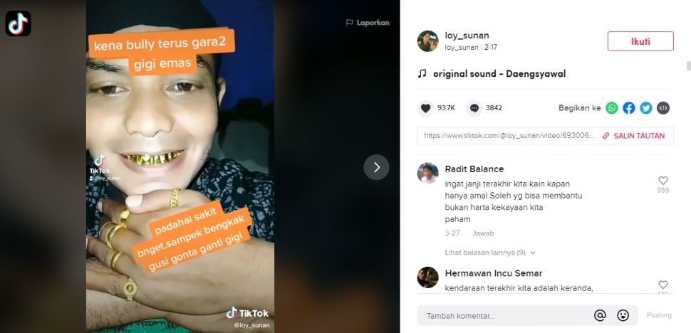 Viral Pria Dibully Usai Ganti Gigi Emas. (TikTok/@loy_sunan)