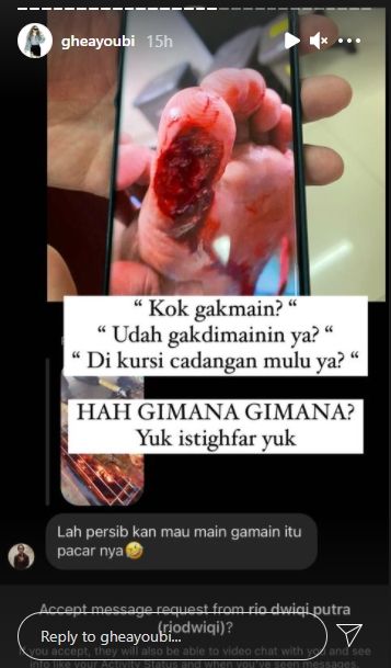 Ghea Youbi bagikan foto luka cedera Gian Zola yang mengerikan. (Instagram/gheayoubi)