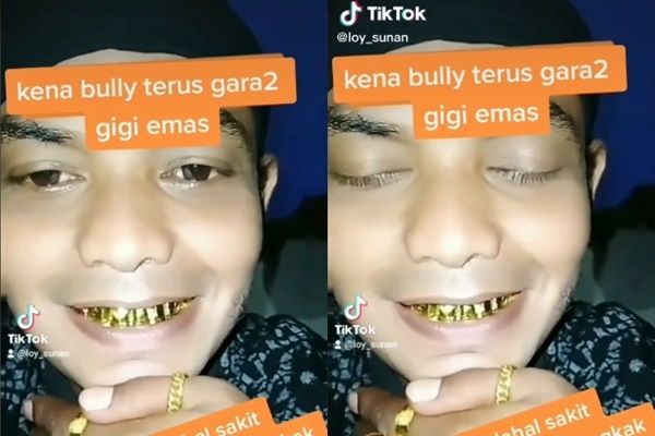 Viral Pria Dibully Usai Ganti Gigi Emas. (TikTok/@loy_sunan)