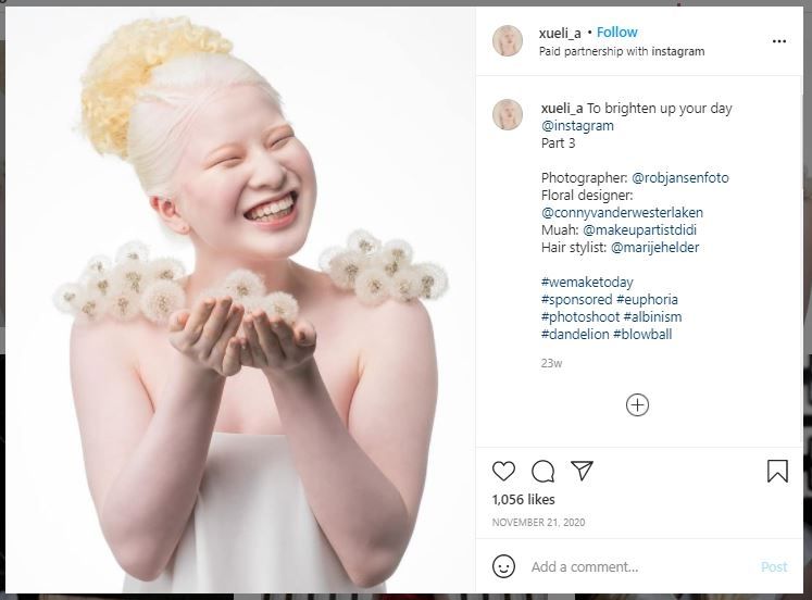 Model Albinisme Xueli Abbing (instagram.com/xueli_a)