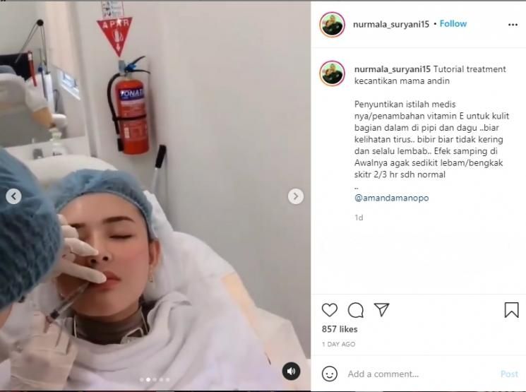 Perawatan yang dilakukan Amanda Manopo. (Instagram/nurmala_suryani15)