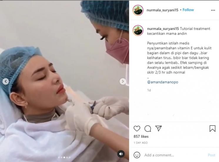 Perawatan yang dilakukan Amanda Manopo. (Instagram/nurmala_suryani15)