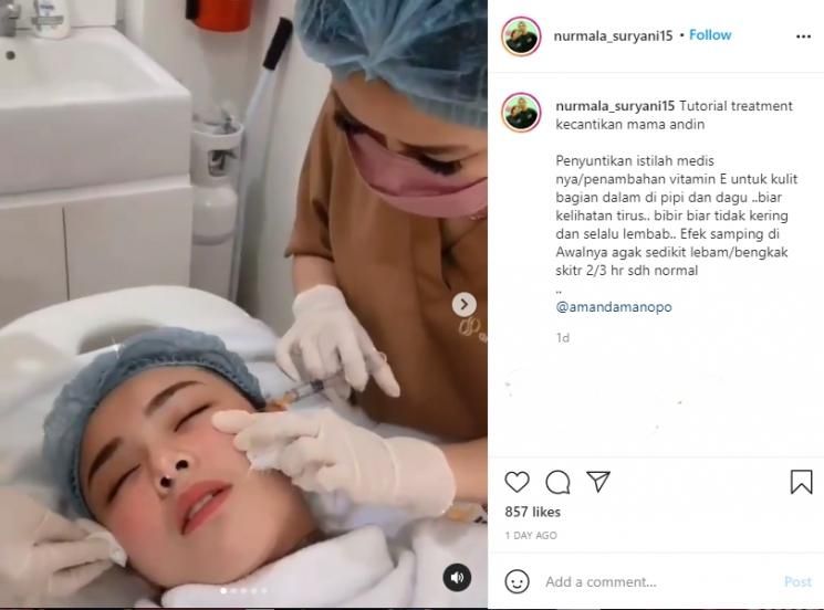 Perawatan yang dilakukan Amanda Manopo. (Instagram/nurmala_suryani15)