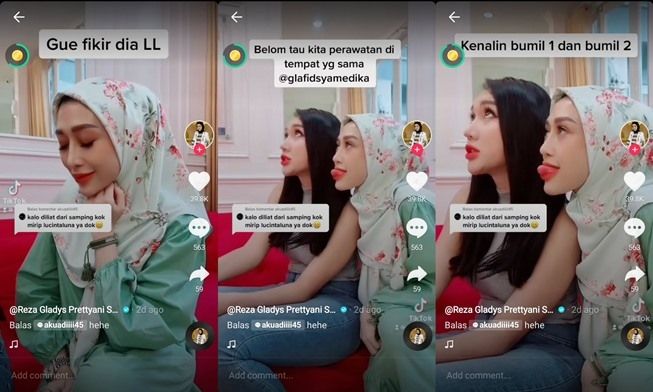 Wajah Dibilang Mirip Lucinta Luna, Reza Gladys Dituding Operasi Plastik. (TikTok/@rezagladys)