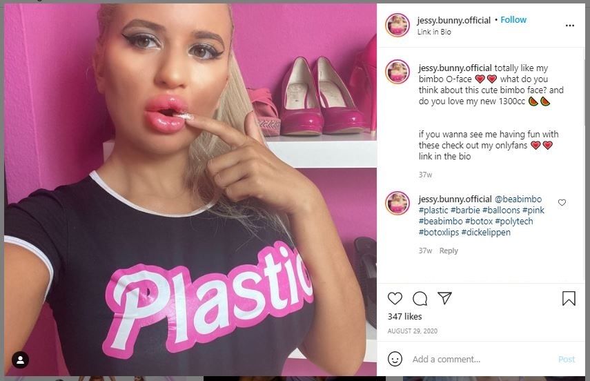 Dulu Dilarang Tampil Feminin, Wanita Ini Terobsesi Oplas Mirip Barbie