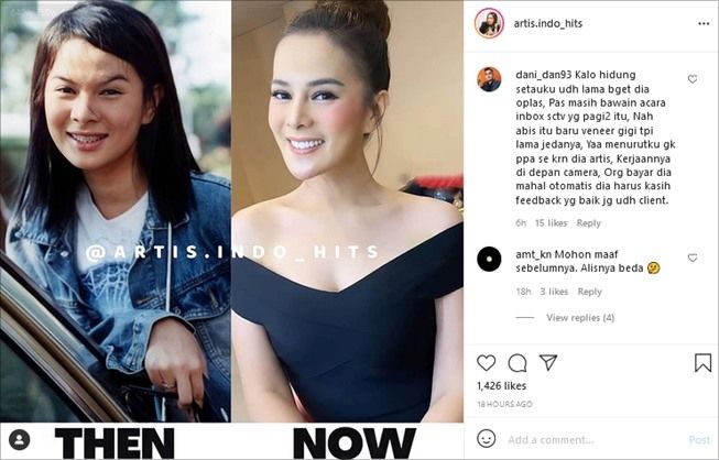 Gara-gara Unggahan Ini, Isu Astrid Tiar Operasi Plastik Dibahas Lagi. (Instagram/@artis.indo_hits)