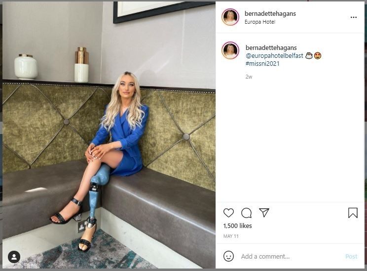 Bernadette Hagans, Model yang Ikut Kontes Kecantikan setelah Diamputasi (instagram.com/bernadettehagans)