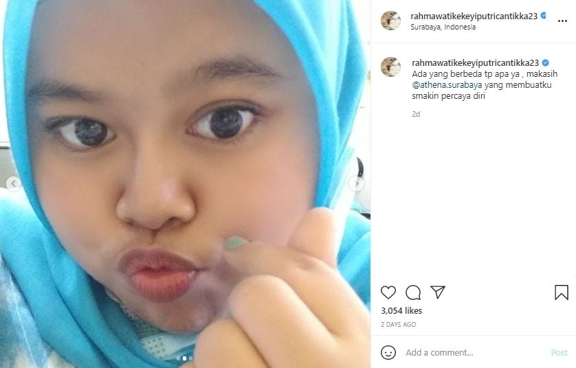 Potret penampilan Kekeyi usai filler hidung. (Instagram/rahmawatikekeyiputricantikka23)