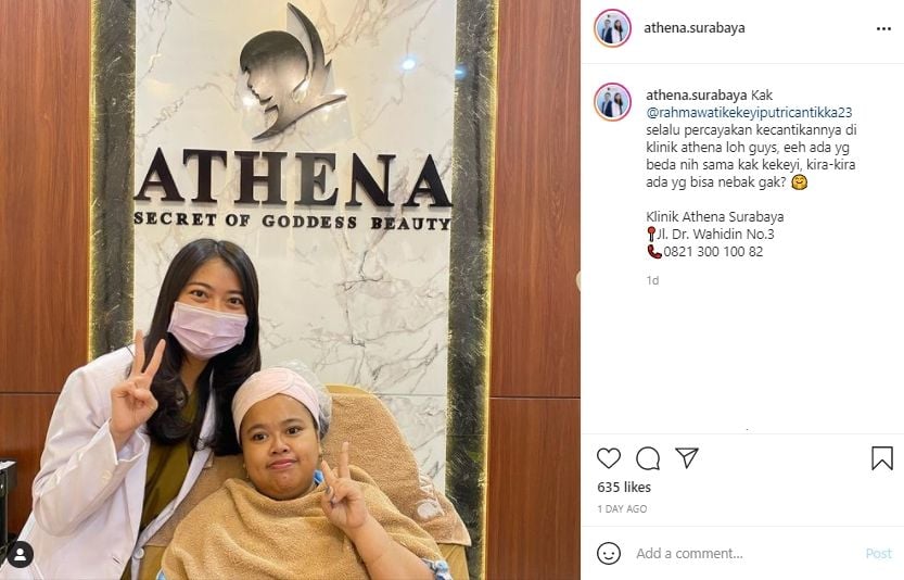 Potret penampilan Kekeyi usai filler hidung. (Instagram/athena.surabaya)