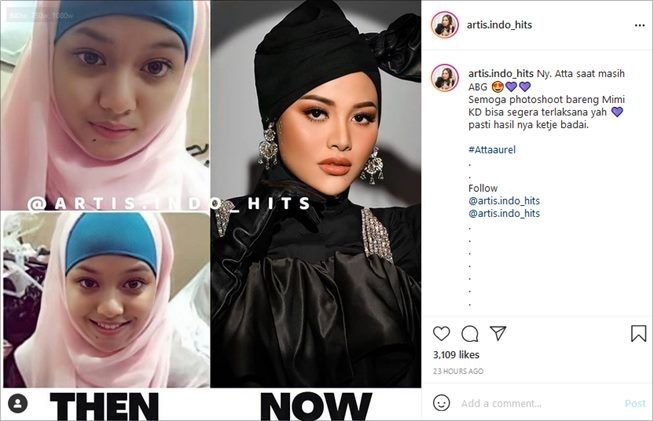 Foto Dulu-Sekarang Dibandingkan, Hidung dan Dagu Aurel Hermansyah Disorot. (Instagram/@artis.indo_hits)