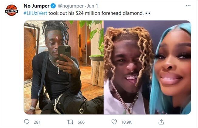 Rapper Lil Uzi Vert lepas implan berlian Rp340 miliar. (Twitter/@nojumper)