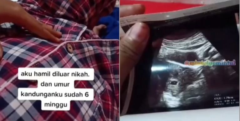 Curhat wanita hamil di luar nikah, pasangan tak tanggung jawab, pergi setelah tunangan viral (Instagram/mintulgemintul).