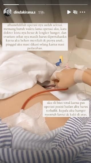 Potret Dinda Kirana usai operasi. (Instagram/dindakirana.s)