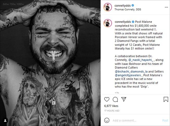 Post Malone pasang berlian Rp22 miliar di gigi. (Instagram/@connellydds)