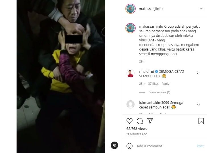 Viral Bocah Kena Penyakit Croup. (Instagram/@makassar_iinfo)