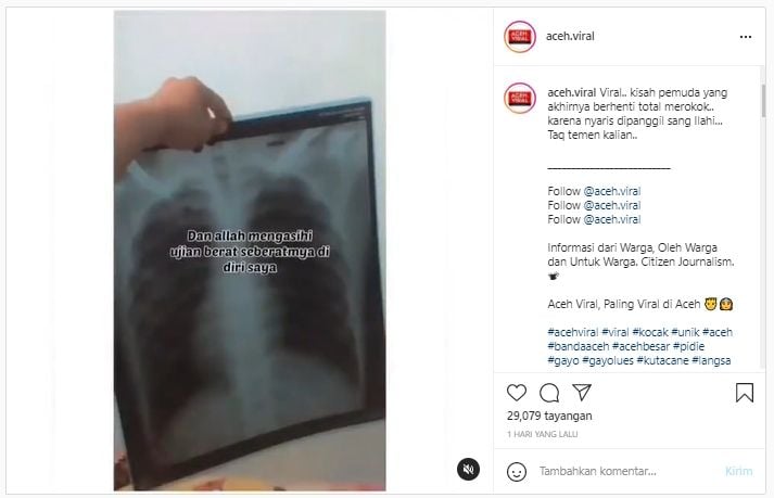 Curhat perokok berat bak dapat mukjizat, pernah koma, nyaris temui ajal (Instagram/aceh.viral).