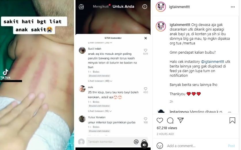 Viral Ibu Curhat Tak Tega Bayinya Dikerok Karena Sakit. (Instagram/@igtainmenttt)