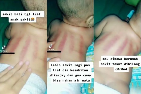 Viral Ibu Curhat Tak Tega Bayinya Dikerok Karena Sakit. (Instagram/@igtainmenttt)