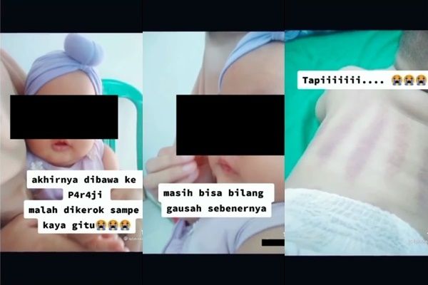 Viral Ibu Curhat Tak Tega Bayinya Dikerok Karena Sakit. (Instagram/@igtainmenttt)