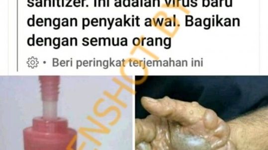 CEK FAKTA Benarkah Handsanitizer Merk Ini Mengandung Virus Baru dan Buat Tangan Melepuh. (Turnbackhoax.id)