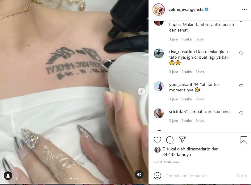 Celine Evangelista hapus tato di dada, yang menunjukkan tanggal pernikahannya dengan Stefan William. [Instagram]