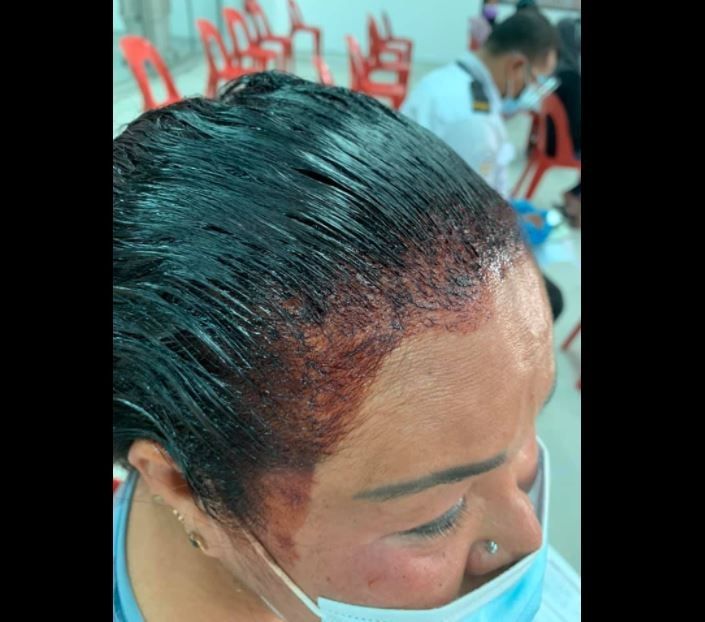Belum Selesai Mengecat Rambut, Ibu Ini Malah Pergi Vaksin (facebook.com/Thian Siew Kim)