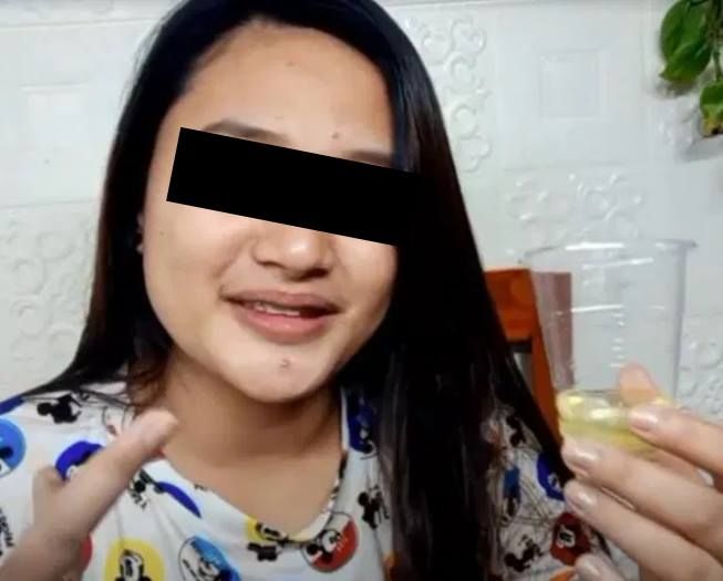 Viral wanita obati jerawat dengan air kencing. (YouTube/Crazy Thess)