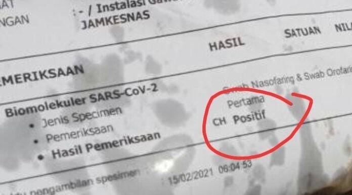 Warga Depok menemukan bungkus gorengan yang terbuat dari dokumen surat hasil tes swab Polymerase Chain Reaction (PCR) Covid-19 yang positif. [Terkini.id]