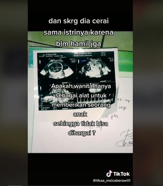 Dituduh Mandul Oleh Mertua, Wanita Ini Hamil setelah Menikah Lagi (tiktok.com/@tikaa_msicaberawit1)