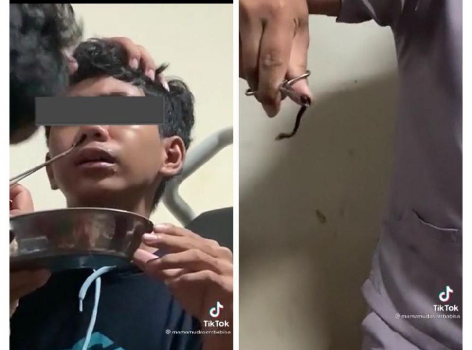 Ada Sesuatu Bersarang di Hidung Remaja Ini (TikTok/mamamudaserrbabisa)