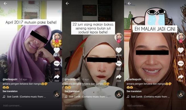 Viral wanita jadi ompong usai pasang behel, ini faktanya. (TikTok/@tarilesputri)