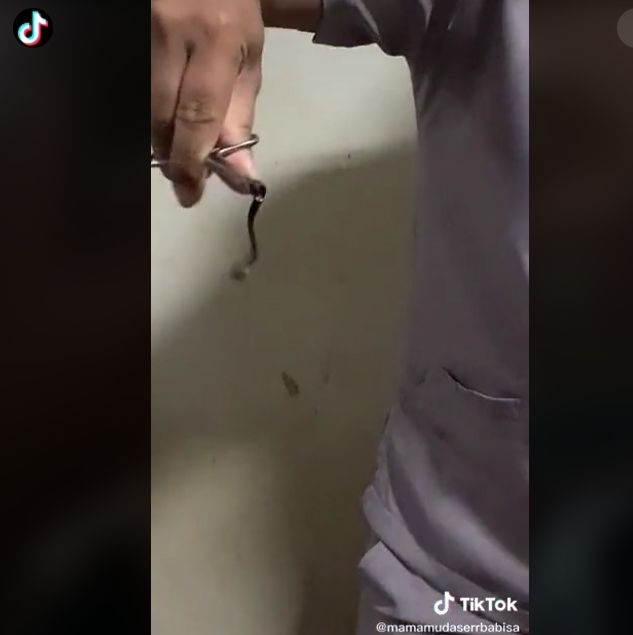 Sering Ngeluh Mimisan, Pas Dicek Ternyata Ada yang Bersarang di Hidung (tiktok)